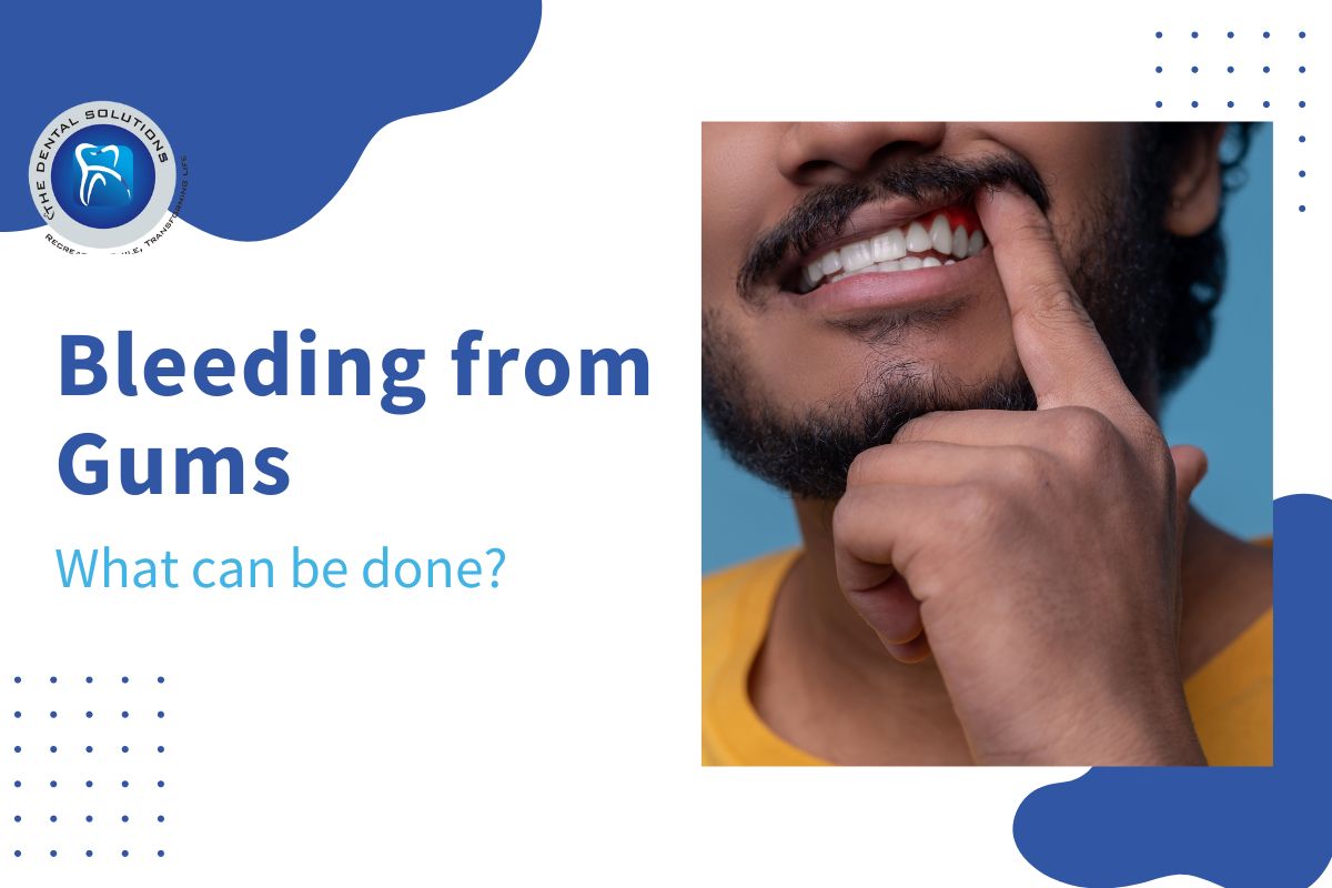 How to stop bleeding gums: Bleeding gums treatment Thane