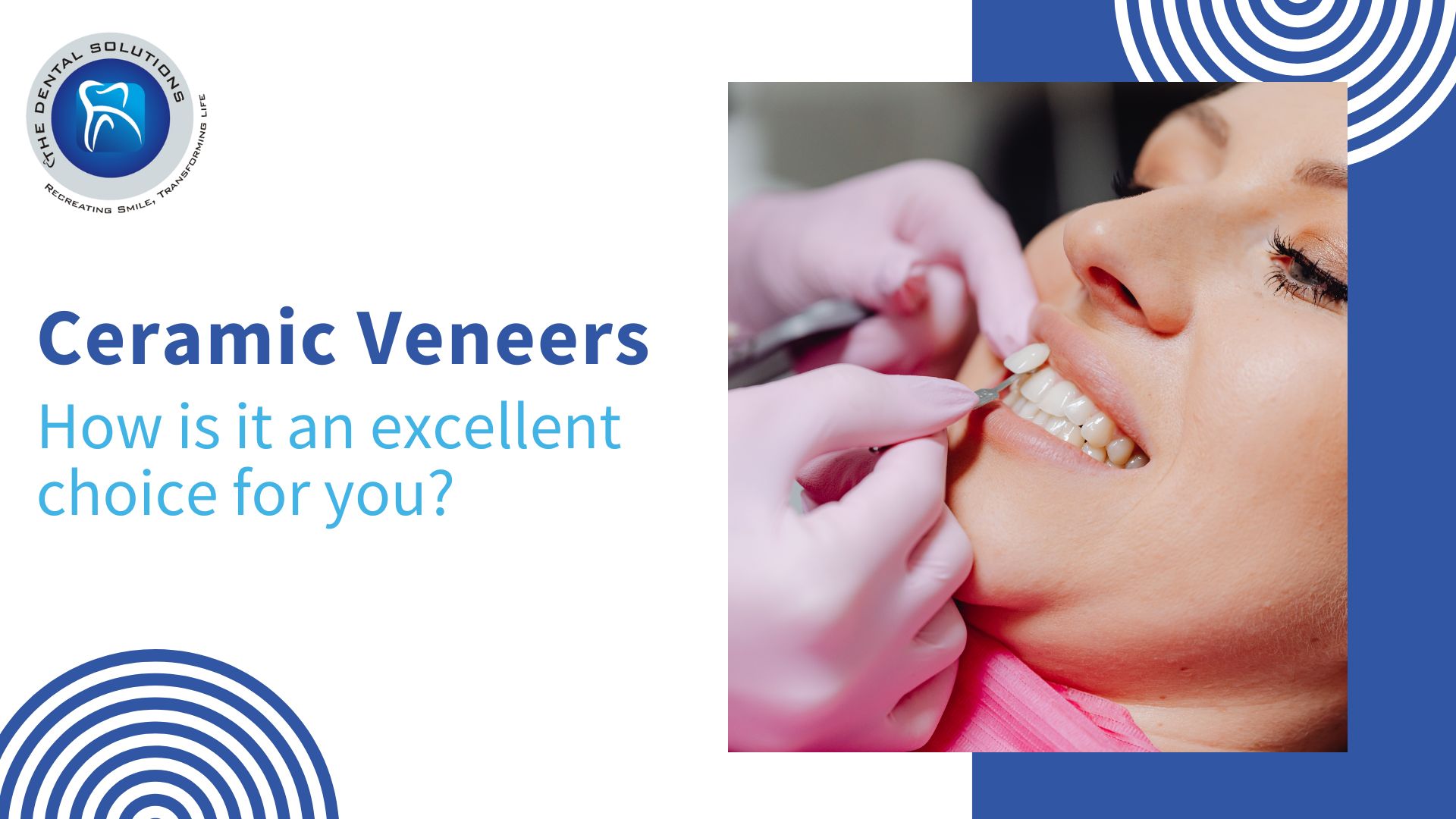 Your ultimate guide to ceramic veneers: Ceramic Veneers Thane