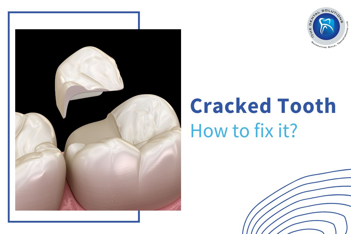 How to fix a Cracked Tooth: Cracked Tooth Treatment Thane