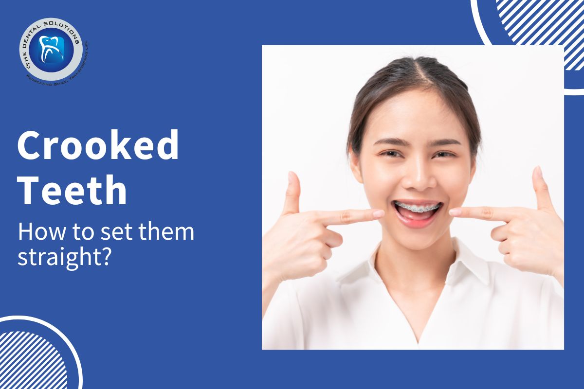 How to get your Crooked Teeth Straight: Crooked Teeth Treatment Thane