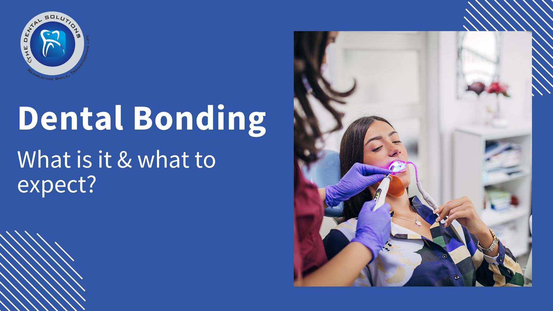 Your complete guide to Dental Bonding Thane