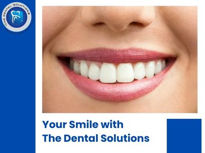 Porcelain Veneers & Dental Implants in Thane, Mumbai – Restore Your Smile with The Dental Solutions