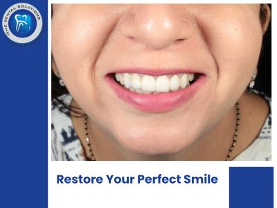 Restore Your Perfect Smile with Expert Dentists and Advanced Dental Implants in Thane