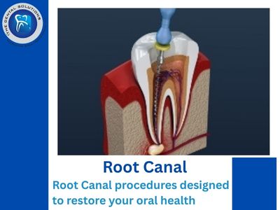 Why Root Canal Treatment Is Worth It: Purpose, Procedure & Key Benefits