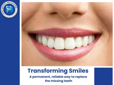 Transforming Smiles in Thane & Beyond with Dental Implants & Smile Makeovers