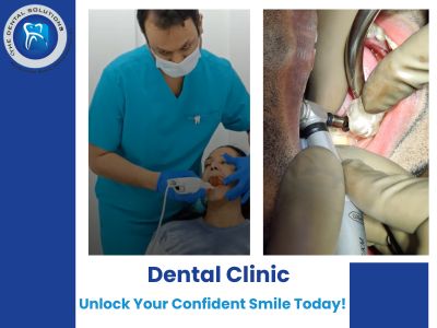 Find the Best Dental Clinic & Dental Implants Near You in Thane for a Confident Smile