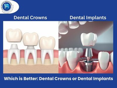 Transform Your Smile: Smile Makeover and Clear Braces