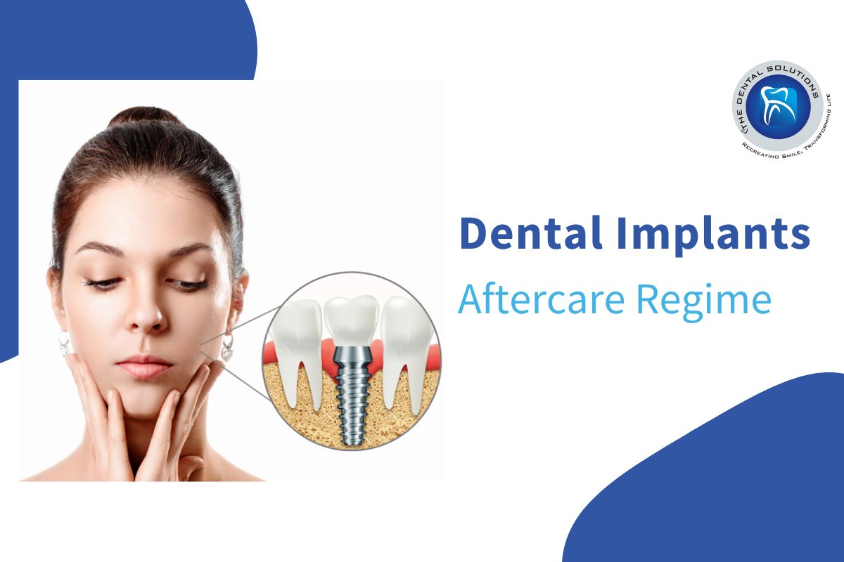 Aftercare regime for Implants: Dental Implants Care Thane