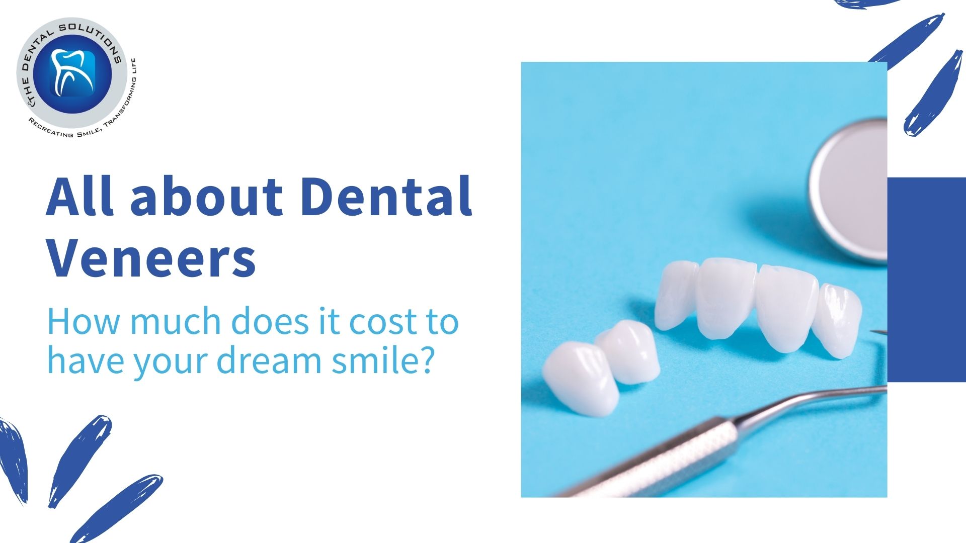 All about Dental Veneers: Dental Veneers Cost