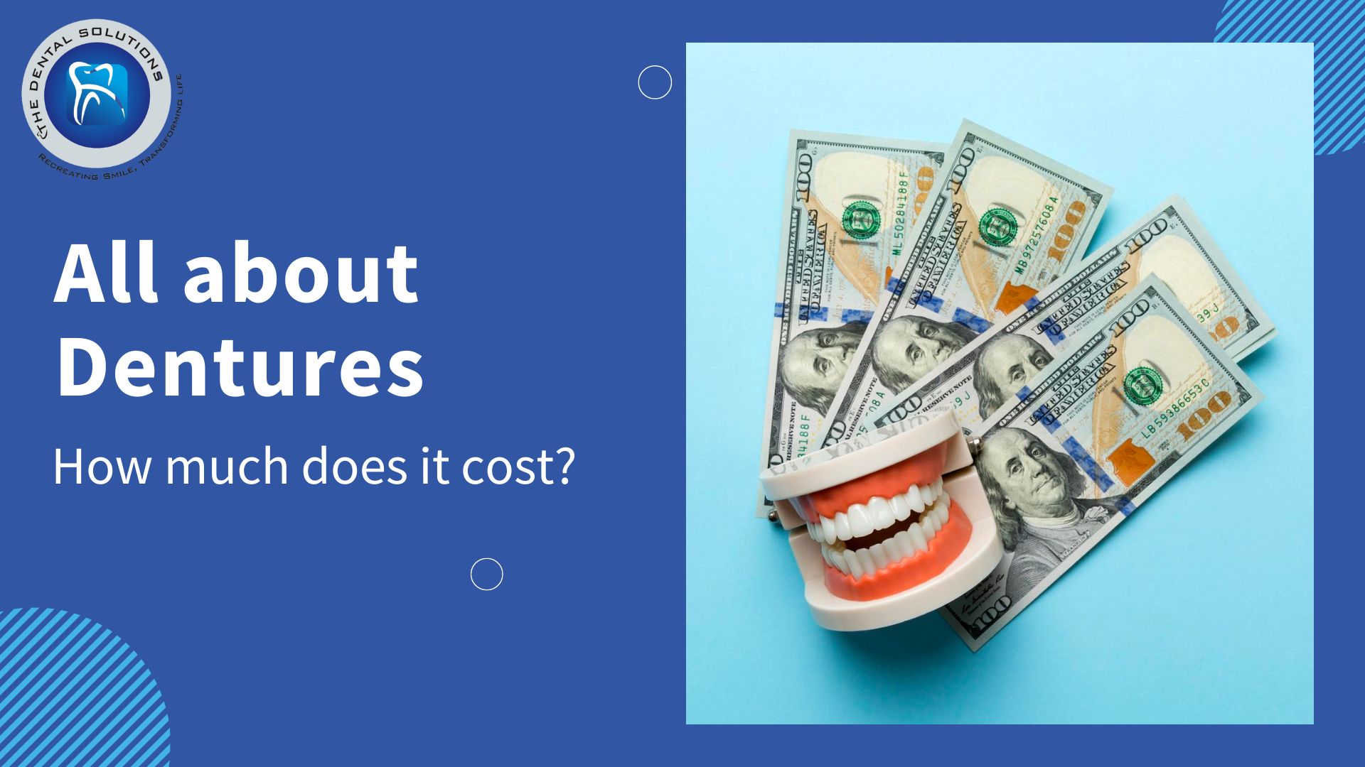 Dentures Cost Thane: All about Dentures