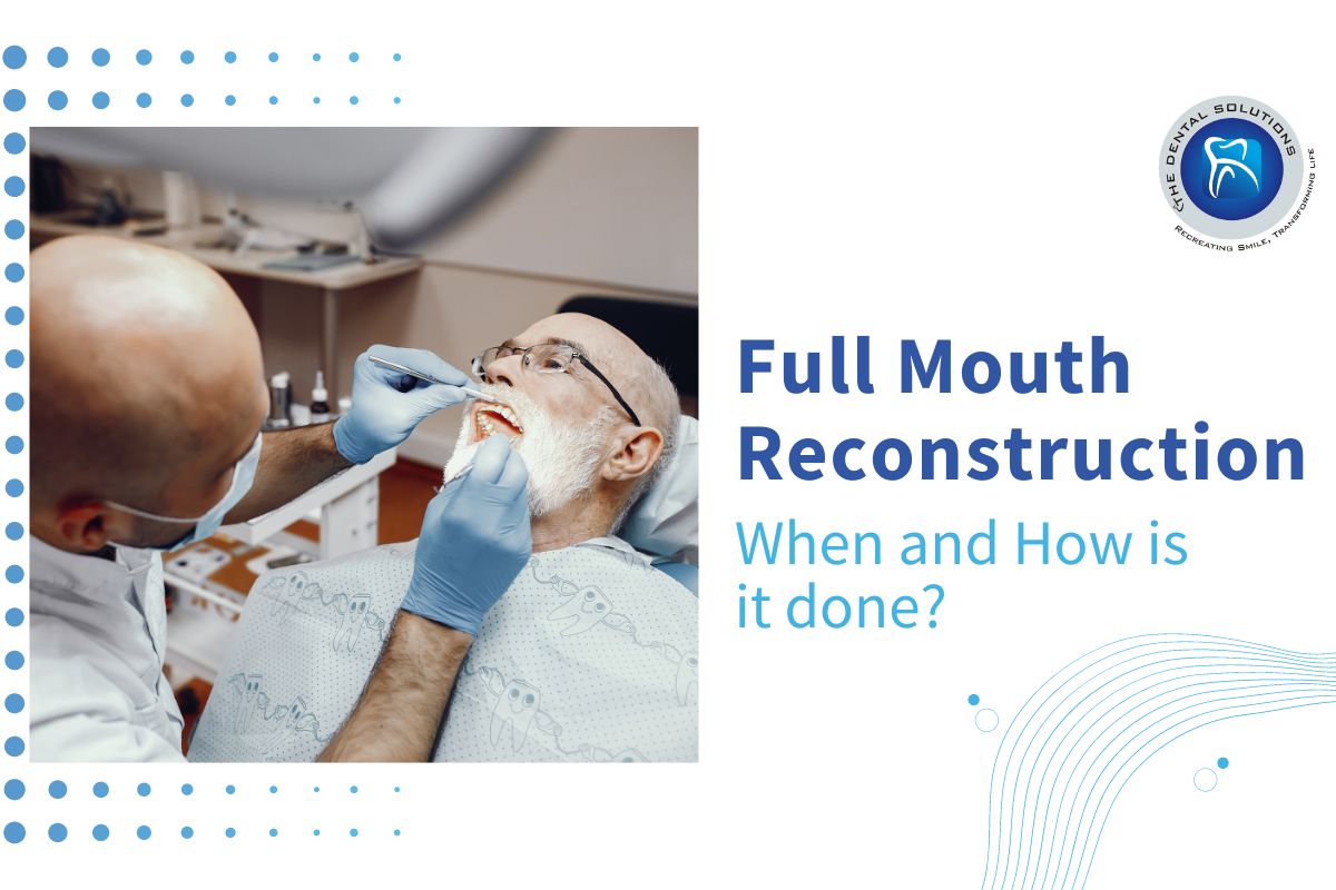 FMR- A brief Overview: Full Mouth Reconstruction Thane
