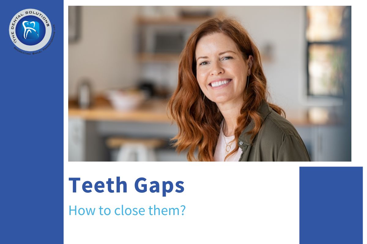How to close gaps