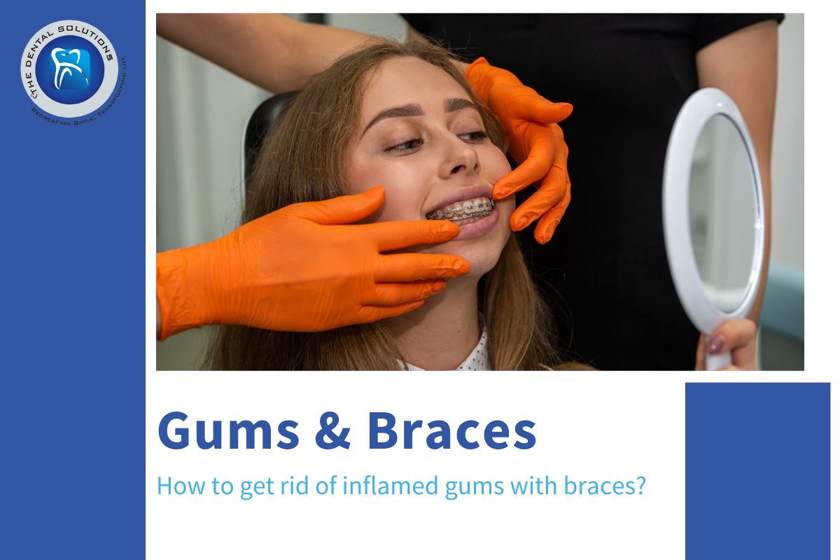 How To Get Rid Of Inflamed Gums With Braces Fast