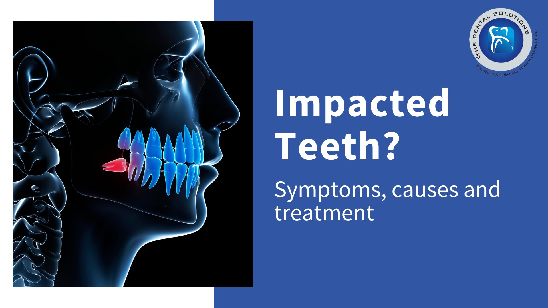 A brief overview of Disimpaction: Impaction Treatment Thane