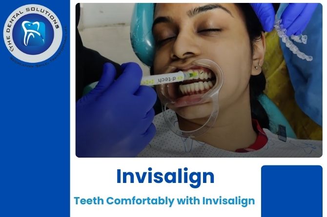 Your Smile, Our Priority – Invisalign & Dental Care in Thane