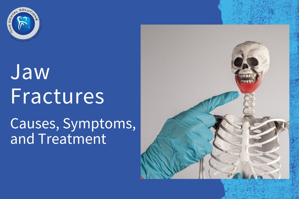 Causes and Treatment of Jaw Fractures: Jaw Fractures Thane