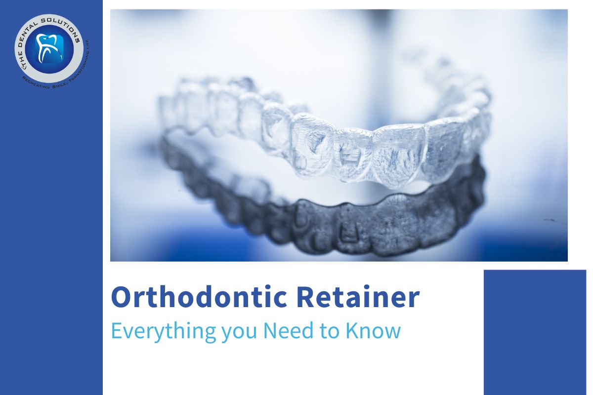 Everything about Orthodontic Retainers - Orthodontic Retainer Treatment Thane