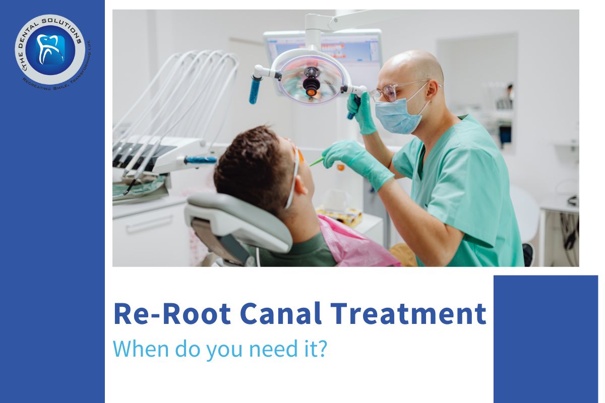When do you need it? - Re-RCT Treatment Thane