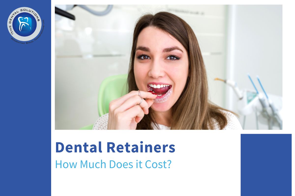 Dental Retainers Cost - Retainers Treatment Cost in Thane