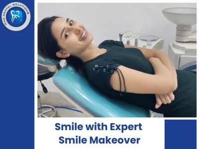 Transform Your Smile with Expert Smile Makeover Treatments at Our Advanced Dental Clinic