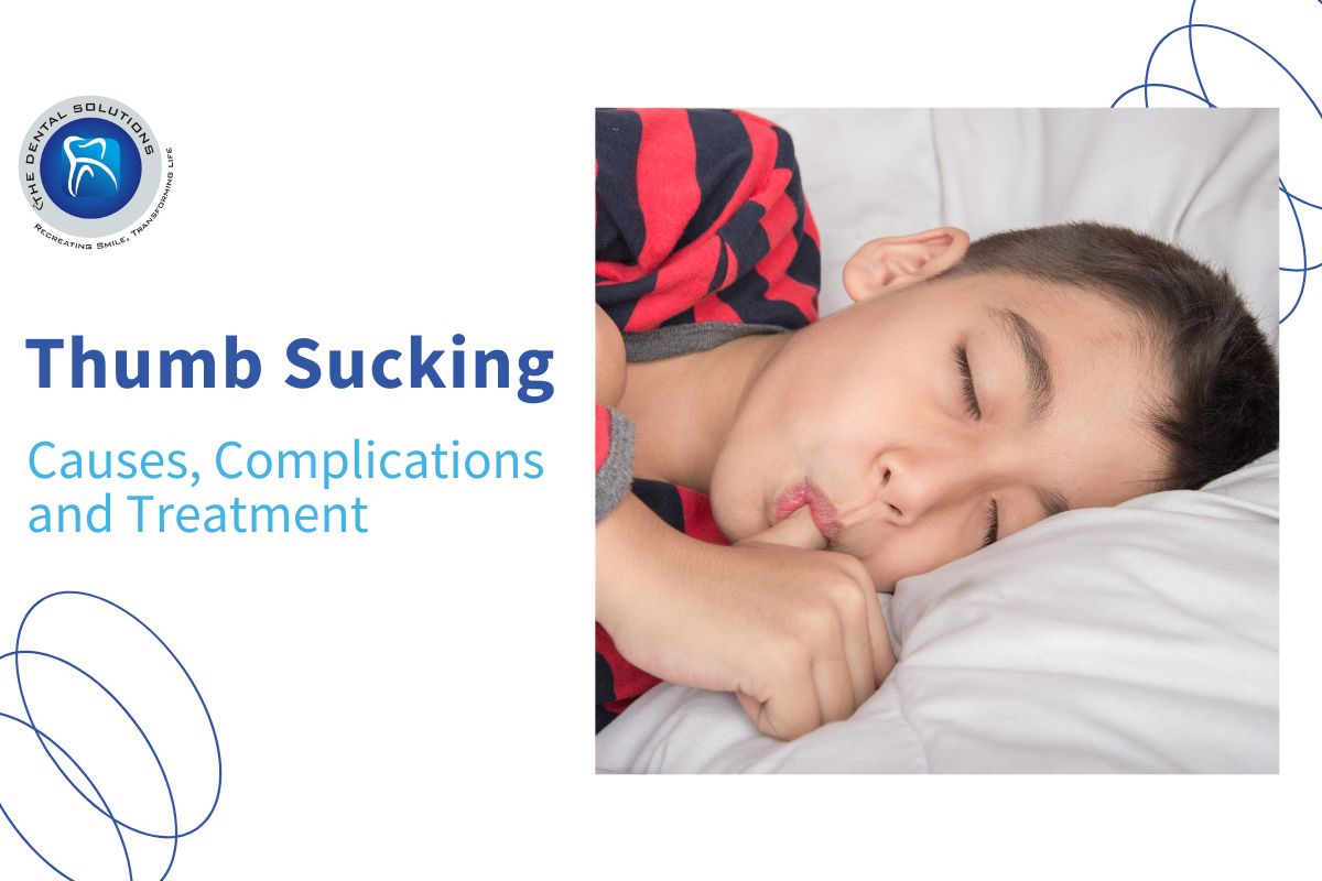 How can you help your child stop Thumb sucking: Thumb Sucking Treatment Thane