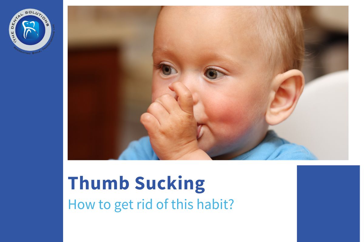 How to get rid of Thumb Sucking Habit in Children? - Thumb Sucking Treatment