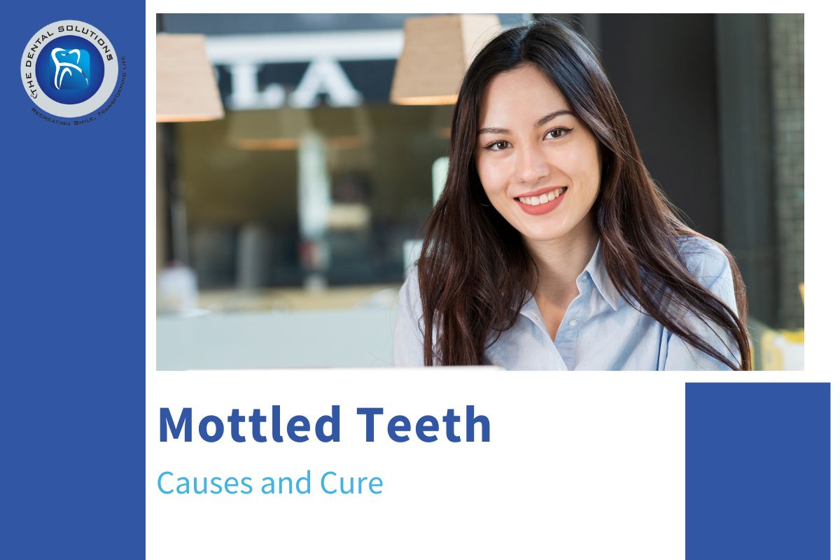 What is mottled teeth