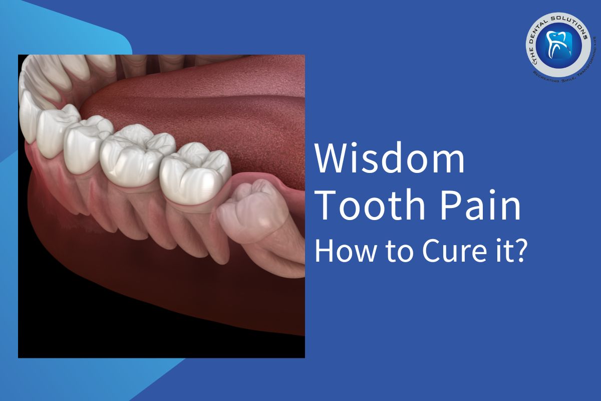 Pain in the wisdom tooth: Wisdom Teeth Treatment Thane
