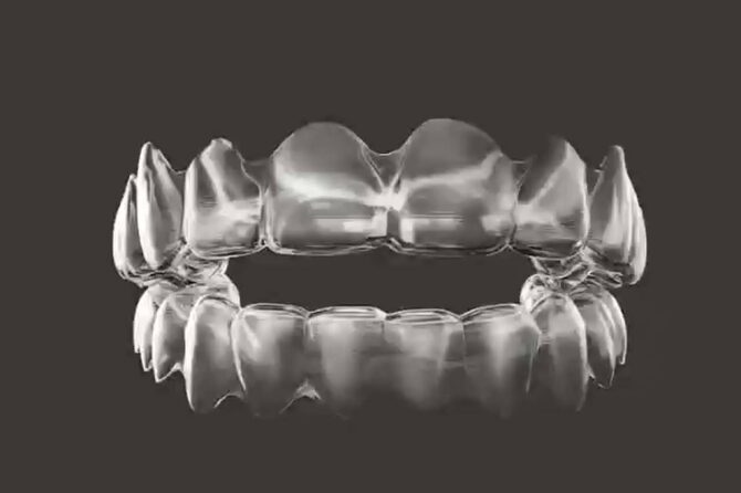 The Dental Solutions [Dental Implants And Invisalign dentist In Thane]