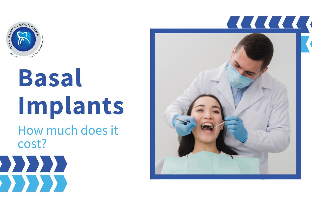 How much does Basal Implants cost: Basal Implants Cost Thane