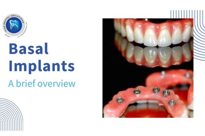 A brief overview of new Implant Variant: Basal Implants Thane