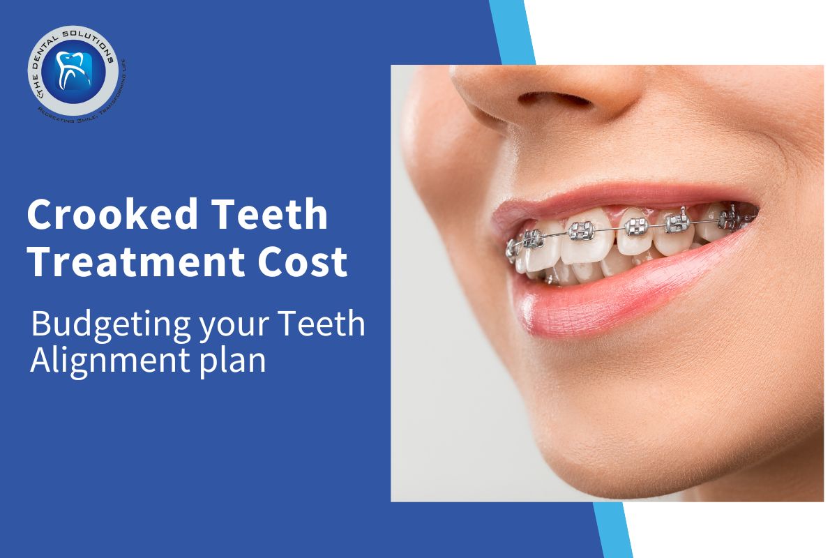 Budgeting your Teeth Alignment: Crooked Teeth Treatment Cost Thane