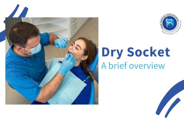 A brief overview of Dry Socket: Dry Socket Thane