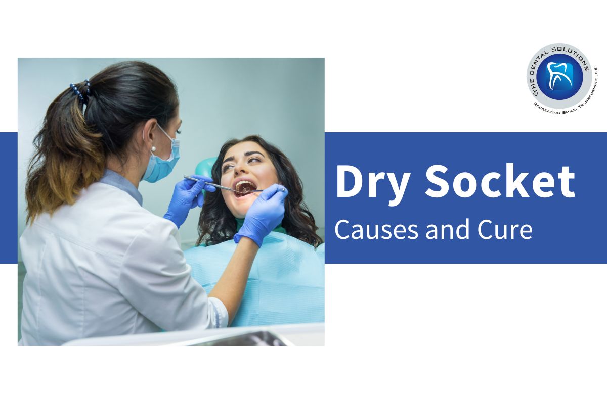 Causes and cure of Dry Socket: Dry Socket Treatment Thane