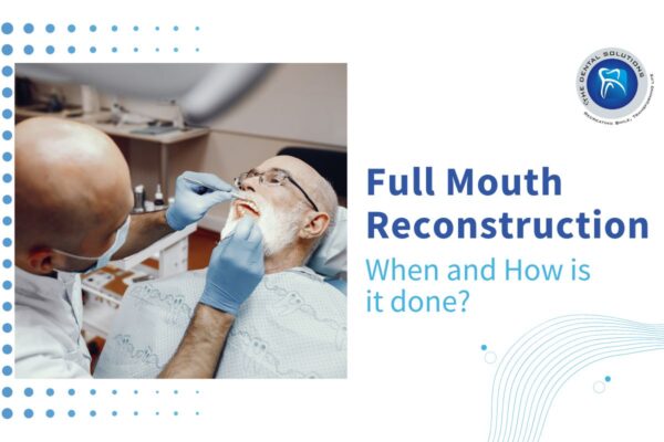 FMR- A brief Overview: Full Mouth Reconstruction Thane