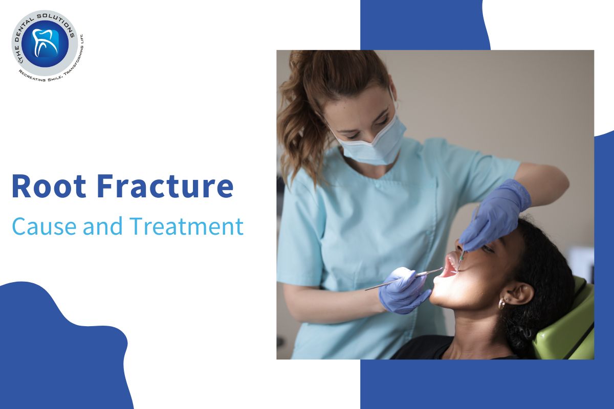 Causes and Cure and Treatment of Root Fracture