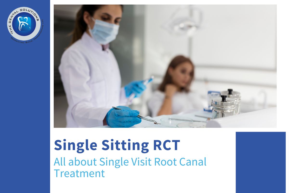 All about Single Visit Root Canal Treatment – Single Sitting RCT Thane