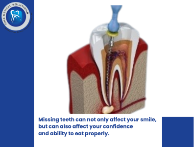 Discover the Best Dentist in Mumbai for Advanced Dental Implants and Complete Oral Care
